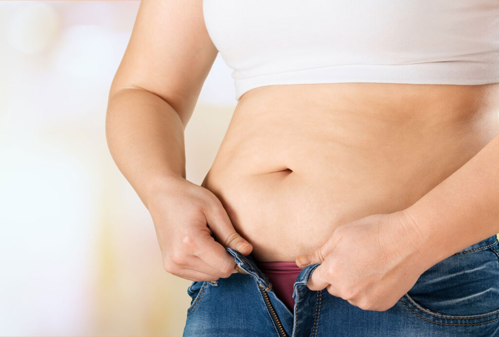 Tummy Tuck